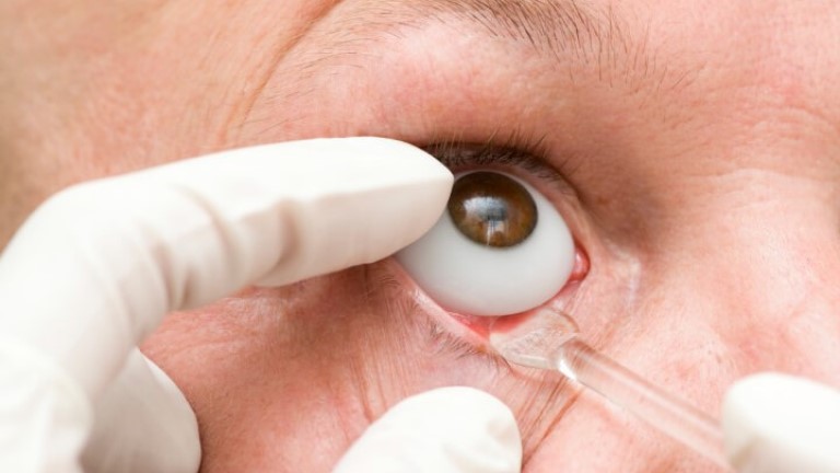 Custom Ocular Prosthesis